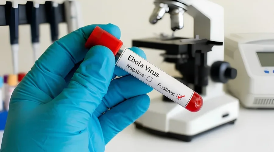 Ebola Virus and Its Symptoms | Travel Scout